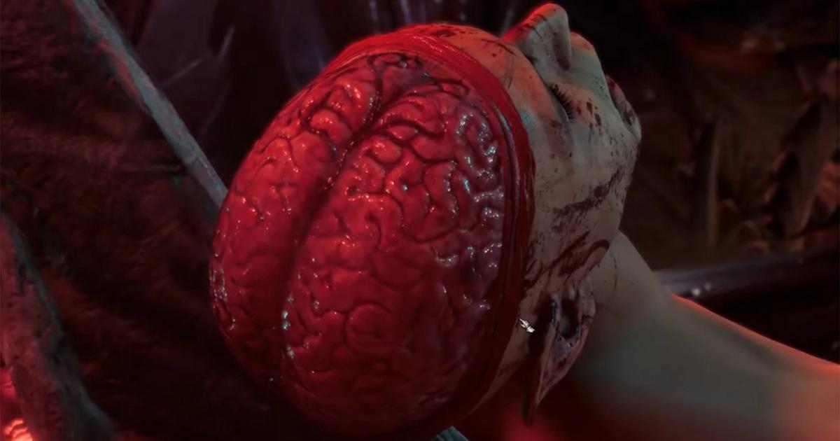 A screenshot of the brain in Baldur's Gate 3.