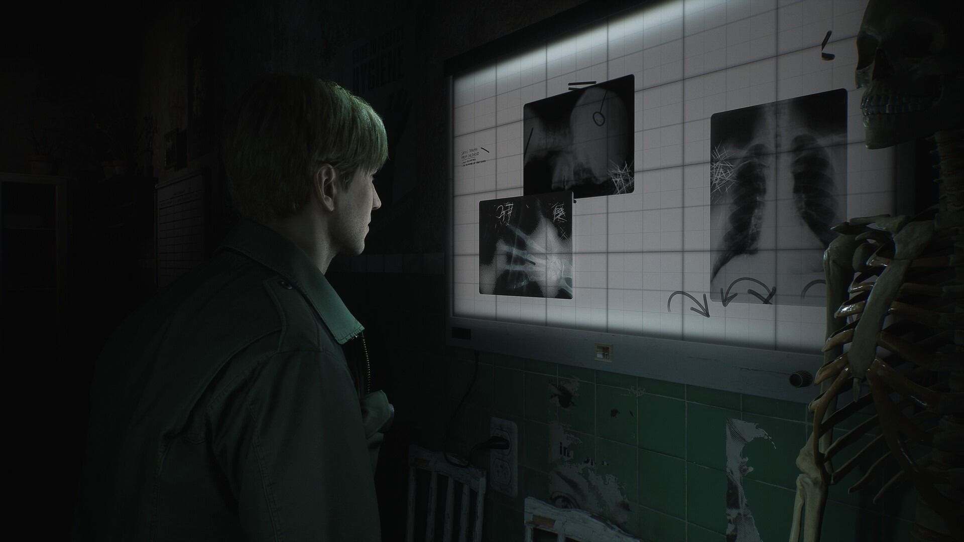 Silent Hill 2 Remake Delivers Classic Horror Vibes, Drawing Resident Evil Comparisons